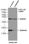 Stathmin 1 antibody, 11157-1-AP, Proteintech Group, Western Blot image 