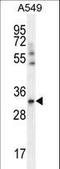 ADP/ATP translocase 3 antibody, LS-B10174, Lifespan Biosciences, Western Blot image 