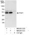 Flap Structure-Specific Endonuclease 1 antibody, NB100-320, Novus Biologicals, Immunoprecipitation image 