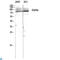 Fibroblast Growth Factor Receptor 4 antibody, LS-C813411, Lifespan Biosciences, Western Blot image 