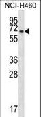 BEN Domain Containing 4 antibody, LS-C156797, Lifespan Biosciences, Western Blot image 