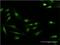 S100 Calcium Binding Protein P antibody, H00006286-M02, Novus Biologicals, Immunocytochemistry image 