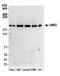 Ubiquitin Protein Ligase E3 Component N-Recognin 2 antibody, A305-416A, Bethyl Labs, Western Blot image 