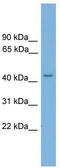 TSPY Like 6 antibody, TA336191, Origene, Western Blot image 