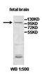 Inter-Alpha-Trypsin Inhibitor Heavy Chain 2 antibody, orb78066, Biorbyt, Western Blot image 
