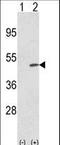 Tribbles Pseudokinase 2 antibody, LS-C160175, Lifespan Biosciences, Western Blot image 