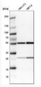 Lamina-associated polypeptide 2, isoforms beta/gamma antibody, NBP1-87822, Novus Biologicals, Western Blot image 