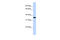 Vestigial Like Family Member 3 antibody, 26-998, ProSci, Enzyme Linked Immunosorbent Assay image 