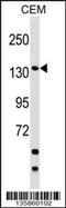 Scaffold Attachment Factor B2 antibody, 58-477, ProSci, Western Blot image 