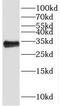 Metabolism Of Cobalamin Associated D antibody, FNab05228, FineTest, Western Blot image 