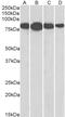 Radixin antibody, 45-137, ProSci, Enzyme Linked Immunosorbent Assay image 