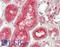 ADAM Metallopeptidase Domain 10 antibody, LS-B13920, Lifespan Biosciences, Immunohistochemistry paraffin image 