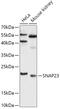 Synaptosome Associated Protein 23 antibody, 15-261, ProSci, Western Blot image 