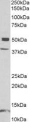 Neuronal Pentraxin 1 antibody, MBS423400, MyBioSource, Western Blot image 