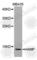 Hepcidin Antimicrobial Peptide antibody, A1601, ABclonal Technology, Western Blot image 