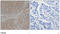 SMAD Family Member 3 antibody, LS-C203065, Lifespan Biosciences, Immunohistochemistry paraffin image 