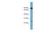 Solute Carrier Family 6 Member 5 antibody, MBS5302496, MyBioSource, Western Blot image 