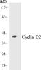 Cyclin D2 antibody, EKC1154, Boster Biological Technology, Western Blot image 