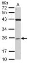 Ubiquitin Conjugating Enzyme E2 F (Putative) antibody, LS-C155553, Lifespan Biosciences, Western Blot image 