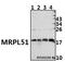 Mitochondrial Ribosomal Protein L51 antibody, A14477-1, Boster Biological Technology, Western Blot image 