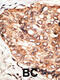 Signal Transducer And Activator Of Transcription 5B antibody, 58-172, ProSci, Immunohistochemistry paraffin image 