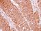 Eukaryotic Translation Initiation Factor 2 Subunit Beta antibody, NBP2-16290, Novus Biologicals, Immunohistochemistry frozen image 