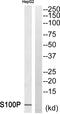 S100 Calcium Binding Protein P antibody, PA5-39375, Invitrogen Antibodies, Western Blot image 