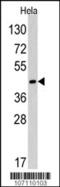 RAD9 Checkpoint Clamp Component A antibody, 62-262, ProSci, Western Blot image 
