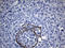 Receptor Tyrosine Kinase Like Orphan Receptor 2 antibody, LS-C792318, Lifespan Biosciences, Immunohistochemistry paraffin image 