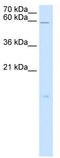 Phospholipase A And Acyltransferase 4 antibody, TA339424, Origene, Western Blot image 