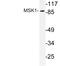 Ribosomal Protein S6 Kinase A5 antibody, LS-C176662, Lifespan Biosciences, Western Blot image 