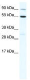 T-Box 21 antibody, TA342330, Origene, Western Blot image 