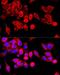 Transient Receptor Potential Cation Channel Subfamily C Member 6 antibody, LS-C750082, Lifespan Biosciences, Immunofluorescence image 