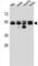 Tubulin Beta 8 Class VIII antibody, abx027305, Abbexa, Western Blot image 