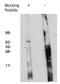 F-Box And WD Repeat Domain Containing 7 antibody, orb109382, Biorbyt, Western Blot image 