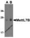 Methyltransferase Like 7B antibody, 4891, ProSci, Western Blot image 