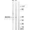 Branched Chain Keto Acid Dehydrogenase Kinase antibody, PA5-49761, Invitrogen Antibodies, Western Blot image 