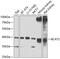 Branched Chain Amino Acid Transaminase 2 antibody, 22-929, ProSci, Western Blot image 