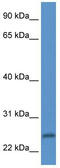 Peptidase Inhibitor 15 antibody, TA343095, Origene, Western Blot image 