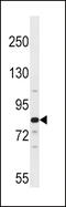 Aryl Hydrocarbon Receptor Nuclear Translocator 2 antibody, 58-559, ProSci, Western Blot image 