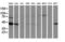 ADP Ribosylation Factor GTPase Activating Protein 1 antibody, LS-C172787, Lifespan Biosciences, Western Blot image 