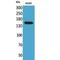 Patatin Like Phospholipase Domain Containing 6 antibody, LS-C387118, Lifespan Biosciences, Western Blot image 