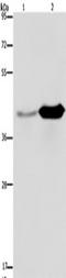Glutamate-Ammonia Ligase antibody, TA350024, Origene, Western Blot image 