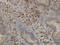 Pantothenate Kinase 2 antibody, LS-C133818, Lifespan Biosciences, Immunohistochemistry paraffin image 