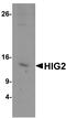 HIG1 Hypoxia Inducible Domain Family Member 2A antibody, PA5-72707, Invitrogen Antibodies, Western Blot image 
