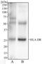 Major Histocompatibility Complex, Class II, DR Alpha antibody, NB100-77855, Novus Biologicals, Western Blot image 