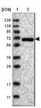 GNAS Complex Locus antibody, NBP1-89753, Novus Biologicals, Western Blot image 