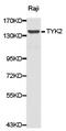 Tyrosine Kinase 2 antibody, LS-C192922, Lifespan Biosciences, Western Blot image 