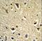 Cytochrome P450 Family 2 Subfamily E Member 1 antibody, LS-C167226, Lifespan Biosciences, Immunohistochemistry paraffin image 
