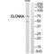 Chloride Voltage-Gated Channel Ka antibody, A06425, Boster Biological Technology, Western Blot image 